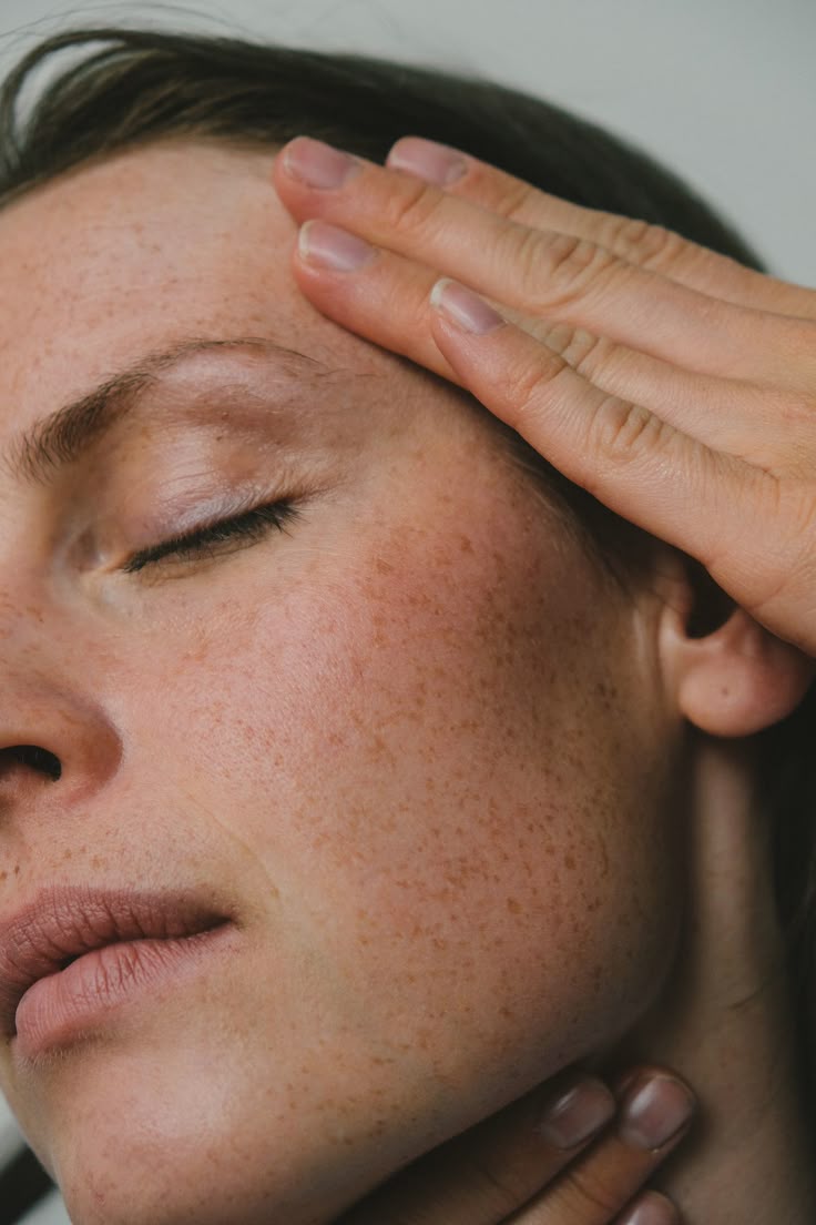 Otoño para tratar las Manchas